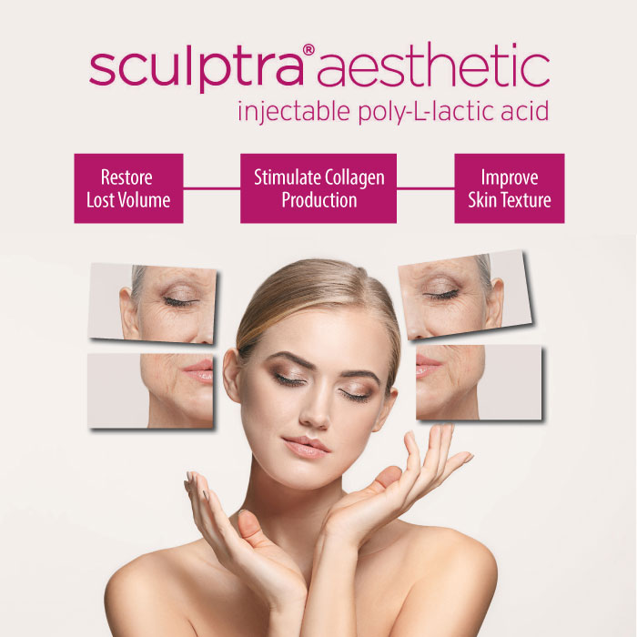 Sculptra collagen biostimulator